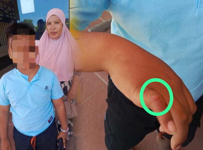 Korban AM dan ibu korban saat hendak melapor ke SPKT Polres Pohuwato atas dugaan Penganiayaan. Dok. Arsady